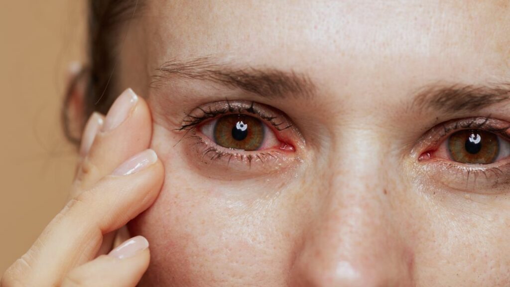 Eye Infections Treatment